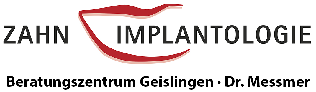 Zahn Implantologie Beratungszentrum Geislingen